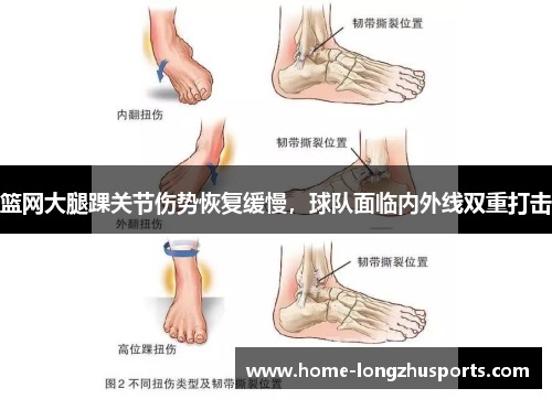 篮网大腿踝关节伤势恢复缓慢，球队面临内外线双重打击